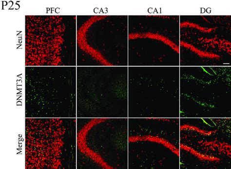 Double Immunostaining Of Dnmt3a And NeuN In Postnatal Day P 25 Mice