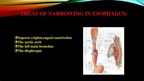 Ppt Dysphagia Causes And Management Powerpoint Presentation Free