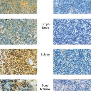 Immunohistochemical Analysis Of Spleen Thymus Lymph Node And Bone