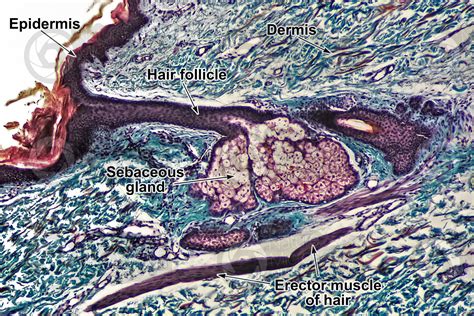 Man Sebaceous Gland Vertical Section 64X Sebaceous Gland Mammals