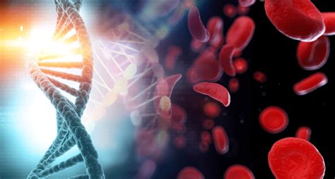 This Gene Editing Therapy Could Cure Sickle Cell Disease And Its