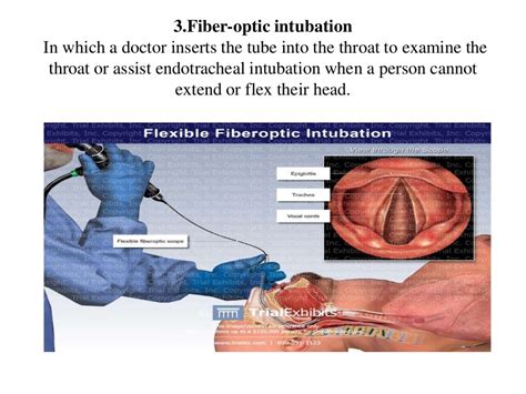 Intubation ppt