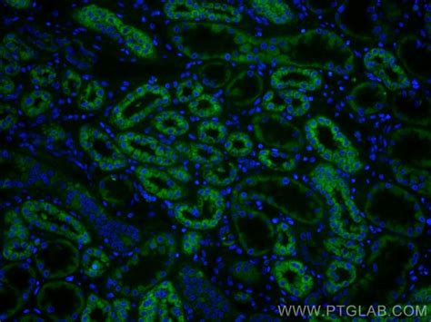 Pccb Monoclonal Antibody A A Coralite Proteintech L