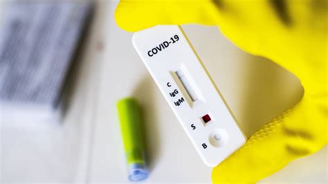 What Role Pharmacies Will Play In Coronavirus Testing