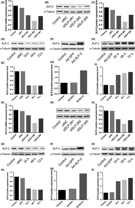 Stomatinlike Protein Inhibits Cisplatininduced Apoptosis Through