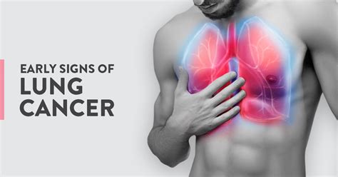 The early signs of Lung Cancer | CK Birla Hospital