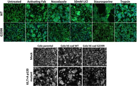 Roles For E Cadherin Cell Surface Regulation In Cancer Molecular