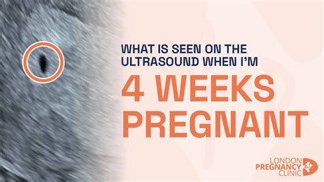 What Does The 4 Week Pregnancy Scan Look Like A London Pregnancy