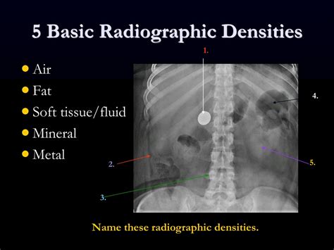 PPT Introduction To Medical Imaging Understanding X Ray Basics