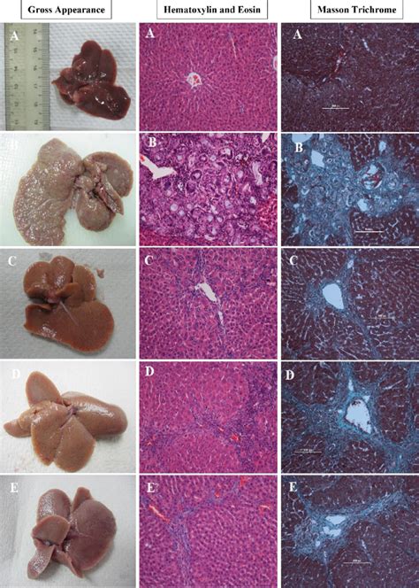 Histopathological Examination Of Liver Tissue Sections Hematoxylin And Download Scientific