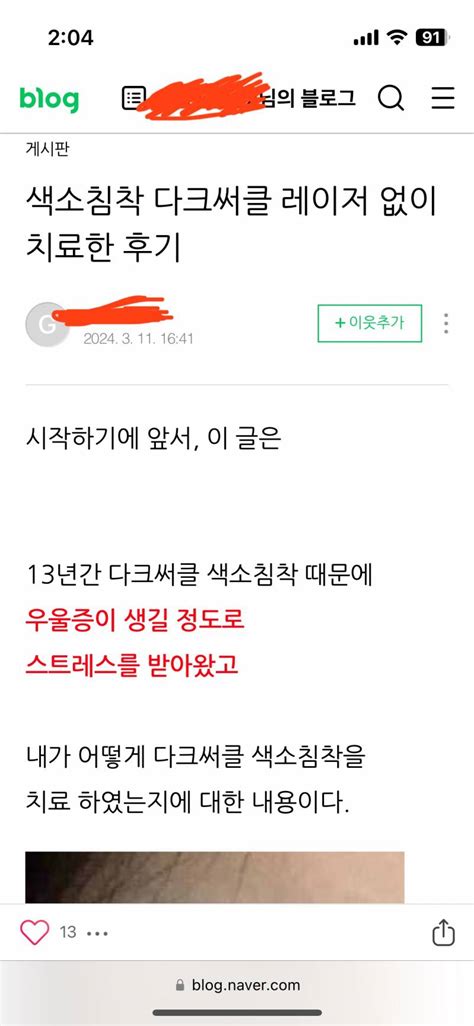 잡담 다크서클 ㅋㅋㅋㅋ 이거 광고지 진짜 나쁜 사람들 많다 인스티즈instiz 일상 카테고리