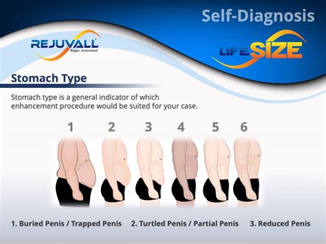 Deciding Best Penile Lifesize Enlargement Rejuvall