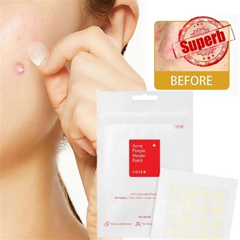 Acne Removal Pimple Patch Breathable Invisible Acne Patch Treatment