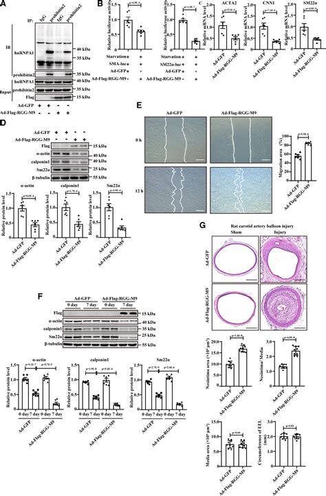 PHB2 Maintains The Contractile Phenotype Of VSMCs By Counteracting PKM2