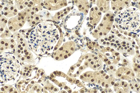 Ddx A Antibody Pbs Proteintech