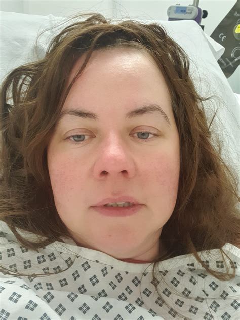 British Mum 42 Diagnosed With Brain Tumour After Being Told Migraines