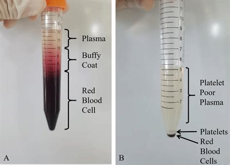 centrifugation  blood  centrifuge illustrations royalty