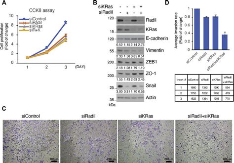 Radil Positively Regulates Cell Proliferation Migration And Emt A