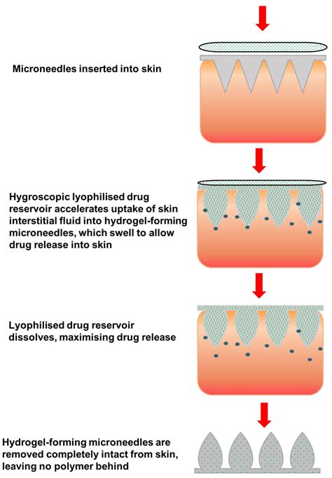 Schematic Representation Of The Concept Of Combining Hydrogel Forming