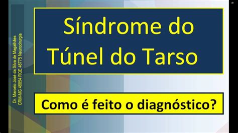 Síndrome do Túnel do Tarso Como é feito o diagnóstico Dr Marcelo