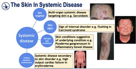 Brs2 The Skin Is Systemic Disease Brs2 Managing Skin Disorders In