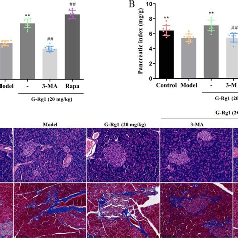 Effect Of G Rg1 On Histopathology Changes Of Pancreas In STZ Induced