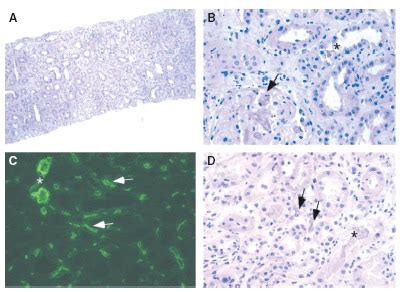 A–D) Biopsy histology and immunopathology. (A) H&E-stained cryostat ...