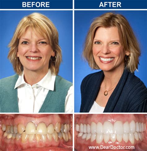 Dear Doctor Magazine Unveils Latest Results Of The Ultimate Smile