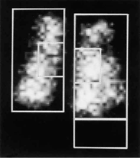 Figure 2 From Ultrafine Particle Deposition And Clearance In The