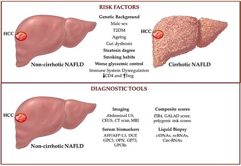 Biomedicines Free Full Text An Overview Of Hepatocellular Carcinoma Surveillance Focusing On