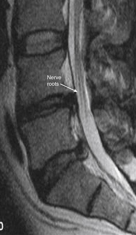 Nerve Root and Facet Blocks and Pain Intervention - Clinical Tree