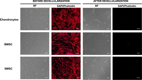 Production Of Decellularized Cell Derived Ecm From Cultures Of Human