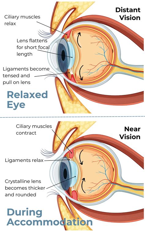 Accommodation Of Eye Definition And Process Accuvision