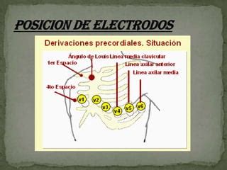 Electrocardiograma PPT Descarga Gratuita