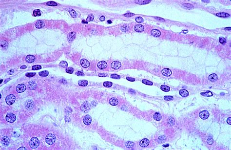 HLS [ Urinary System, kidney, H&E, thin loop of Henle and ascending ...