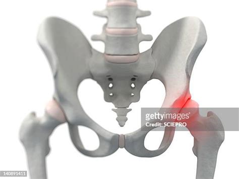 703 Hip Pain Anatomy Stock Photos, High-Res Pictures, and Images ...