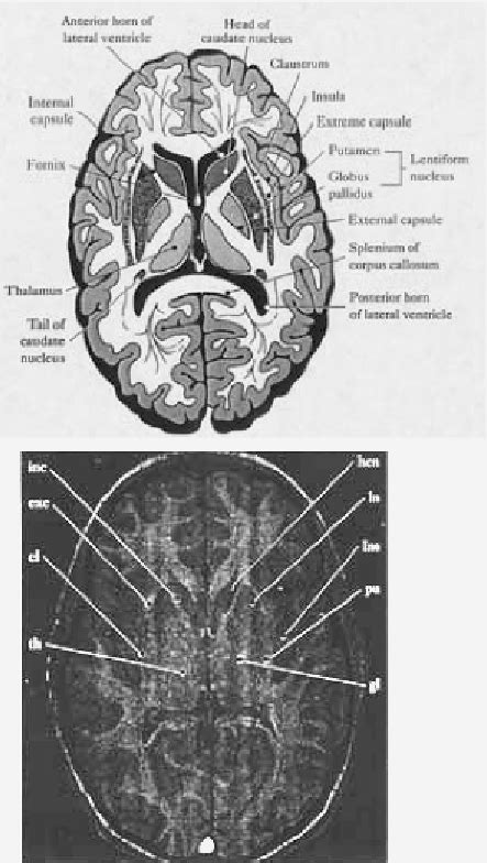 The Image On The Top Is A Diagrammatic Representation Of An Axial View