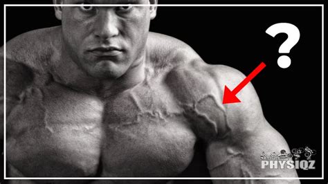 Varicose Veins Bodybuilding: Why It Happens & How to Avoid (Or Fix)