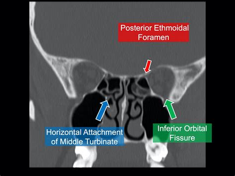 Image Radiopaedia Org