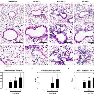 A Representative H E Stained Section Of Lung Tissue B Histological