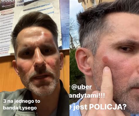 Marcin Bosak pobity na ulicy Padł ofiarą agresywnego kierowcy Nowe