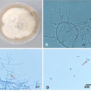 F Verticilloides A Pda B Conidiogenus Cell C Macroconidia D