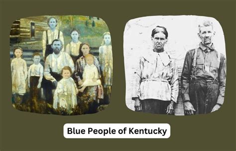 Blue People Of Kentucky Who Are The Blue Fugates