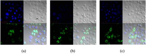 Aqp Localization In Hepg Cells A Hepg Cell Transfected With