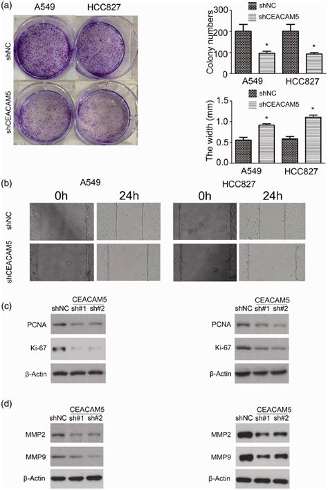 CEACAM5 Stimulates The Progression Of Non Small Cell Lung Cancer By