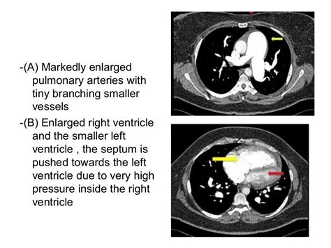 Diagnostic Imaging of Pulmonary Vasculature