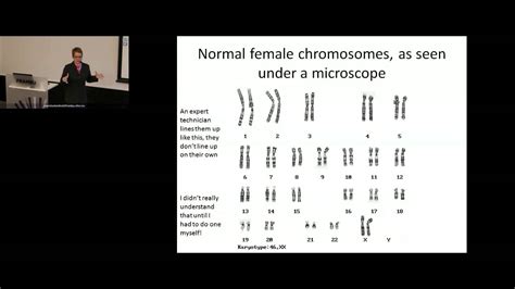 Wolf Hirschhorn Syndrome Symptoms