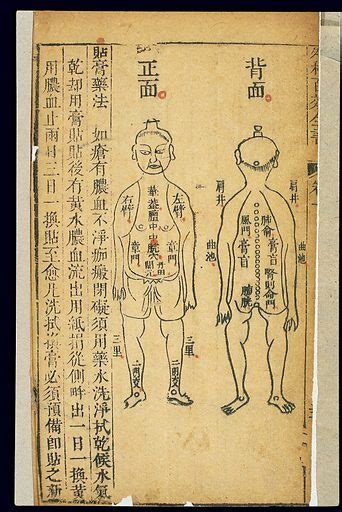 Chinese Woodcuts Locations For Applying Ointments Free Public Domain