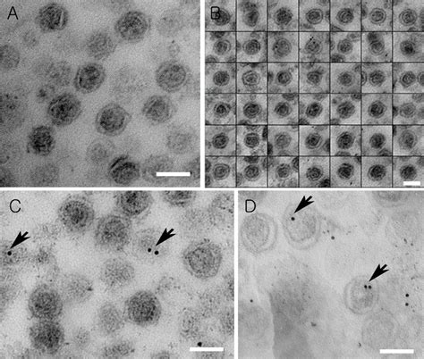 Sample Preparation And Imaging Of Exosomes By Transmission Electron