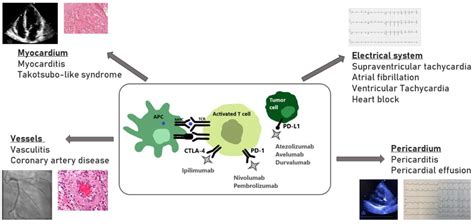 Jcm Free Full Text The Potential Cardiotoxicity Of Immune